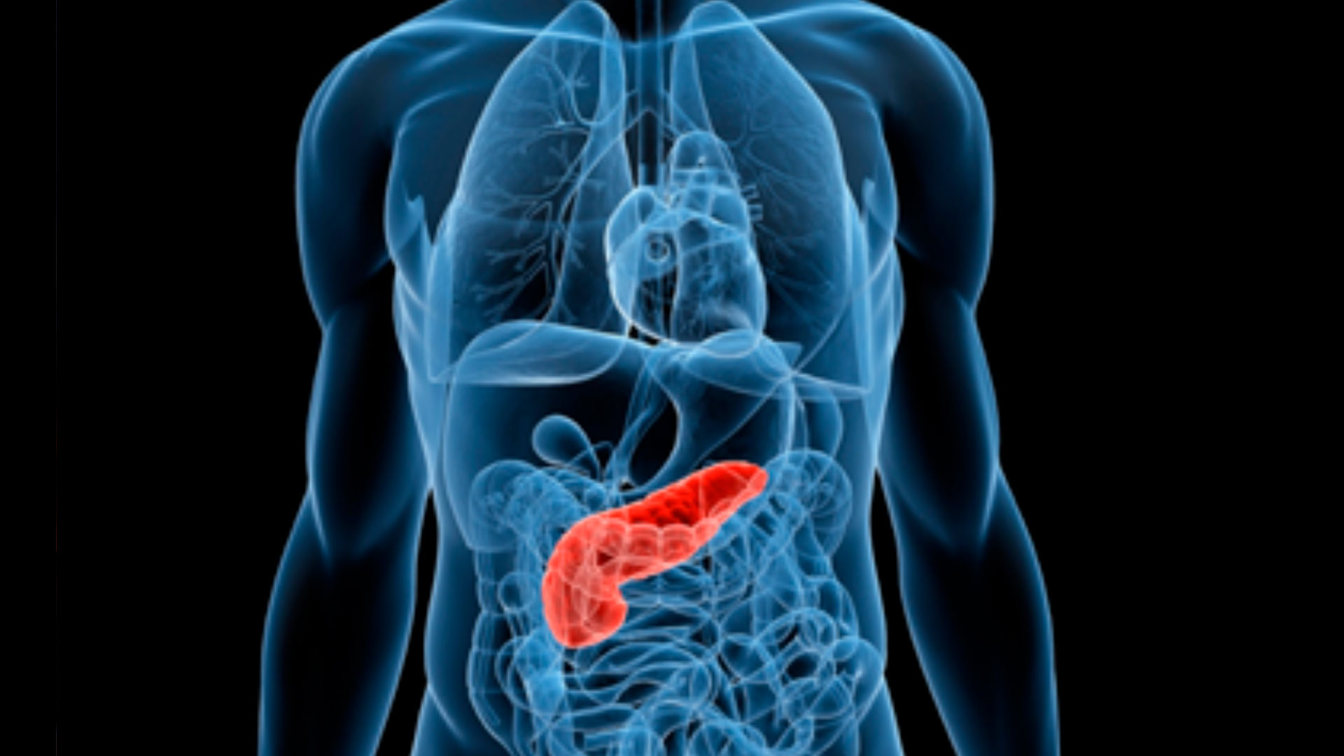 Trapianto di pancreas, una possibile cura per il diabete non ancora considerata dalla comunità scientifica